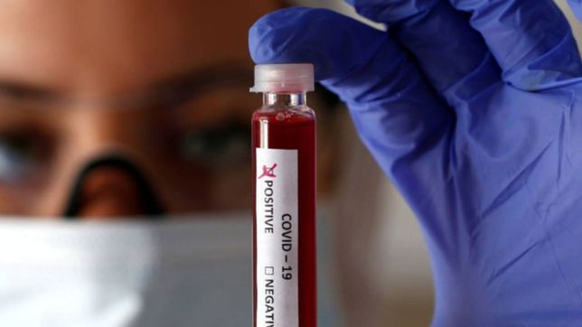 aseguran que el coronavirus se siente particularmente atraido por un grupo sanguineo