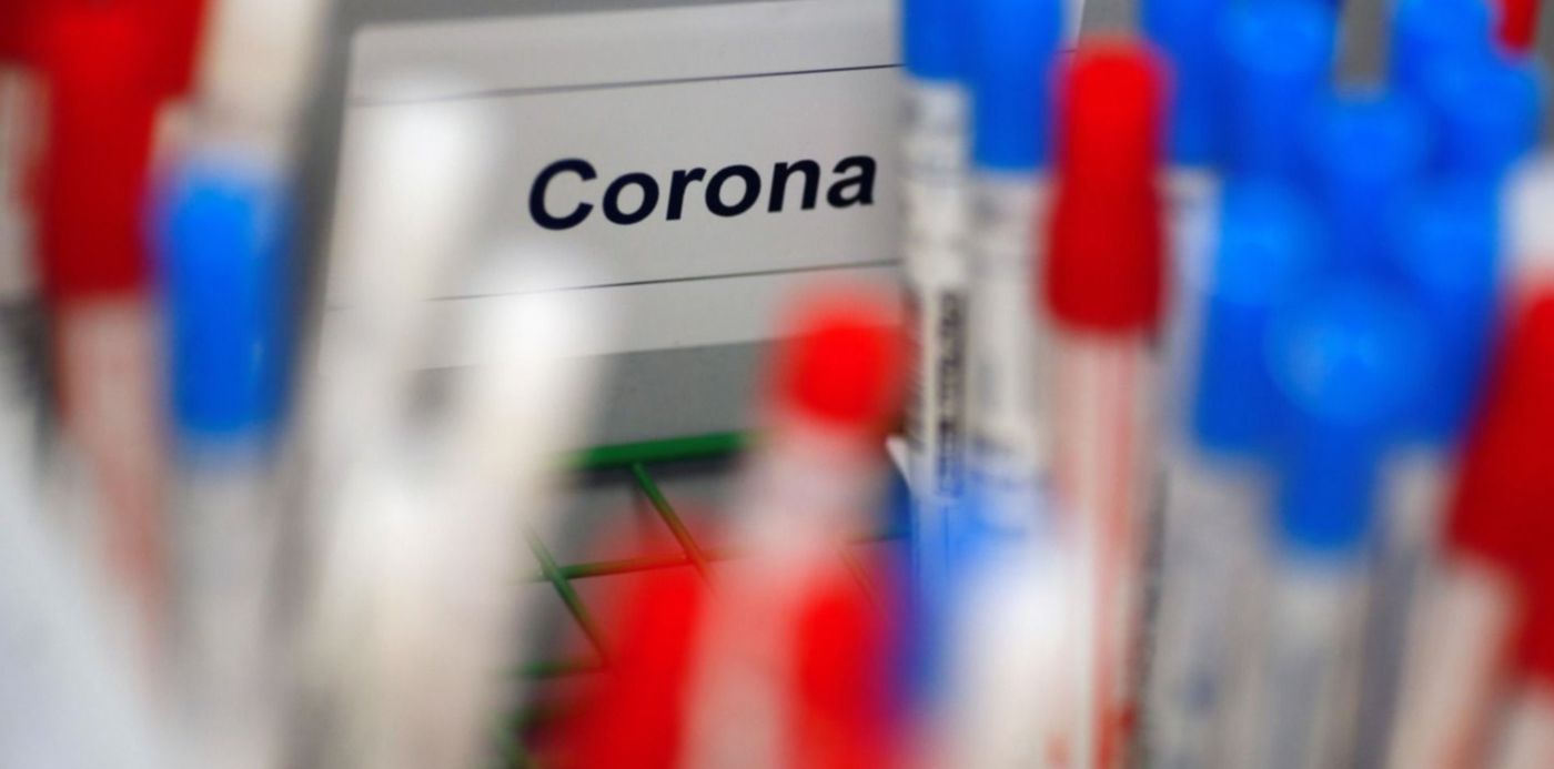 1585424739927.jpg?height=747&scaleX=1&scaleY=1&ow=1500&x=3&y=167&width=1493&rotate=0&oh=1000&&cw=1920&ch=950