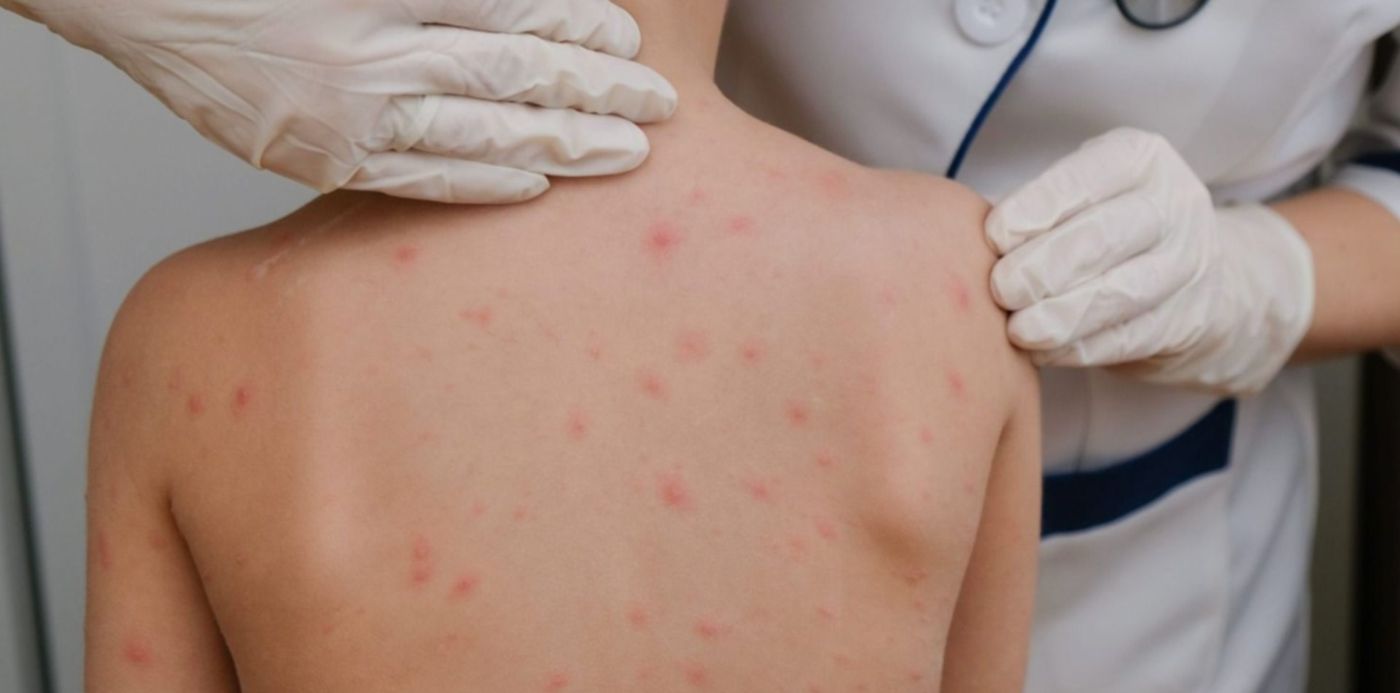 1653659896186.jpg?x=10&y=182&width=1469&height=735&rotate=0&scaleX=1&scaleY=1&ow=1500&oh=1106&&cw=1920&ch=950