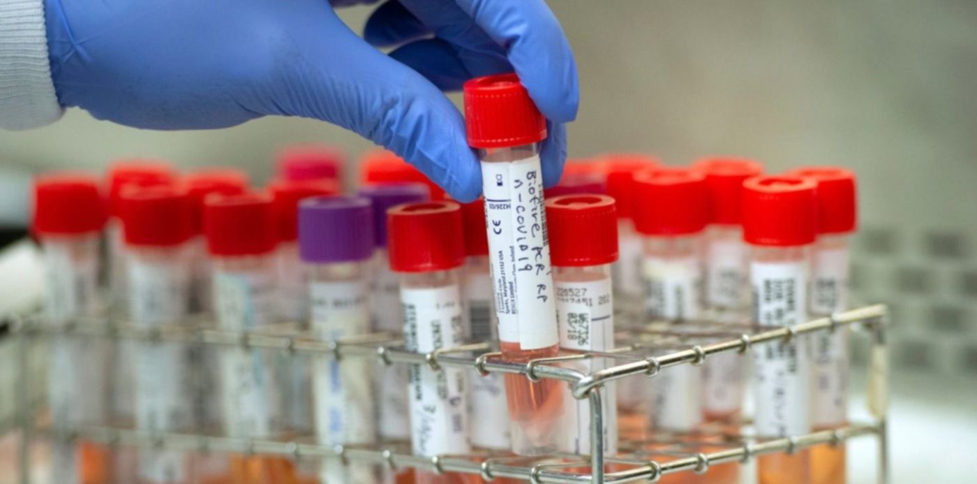 1585424745790.jpeg?width=1477&scaleY=1&ow=1500&oh=968&y=32&height=739&rotate=0&scaleX=1&x=8&&cw=1920&ch=950