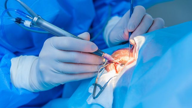 denuncian que el pami paga hasta diez veces mas por lentes usados en cirugias de cataratas