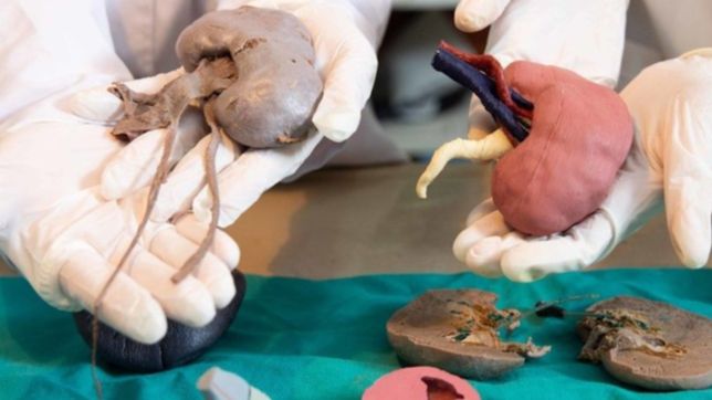 un laboratorio de la unlp implementa tecnologia 3d y anatomia digital para las cirugias