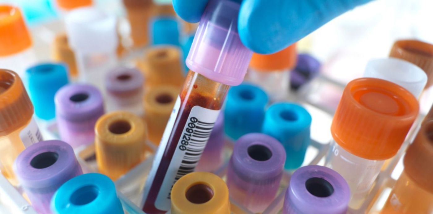 1587522143388.jpg?x=8&width=1492&height=746&oh=1124&y=161&rotate=0&scaleX=1&scaleY=1&ow=1500&&cw=1920&ch=950