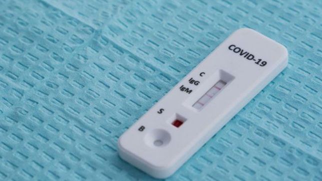 un estudio revelo cuanto duran los anticuerpos contra el coronavirus