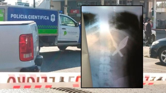 el doloroso metodo que uso el preso internado en la plata para fugarse de la carcel