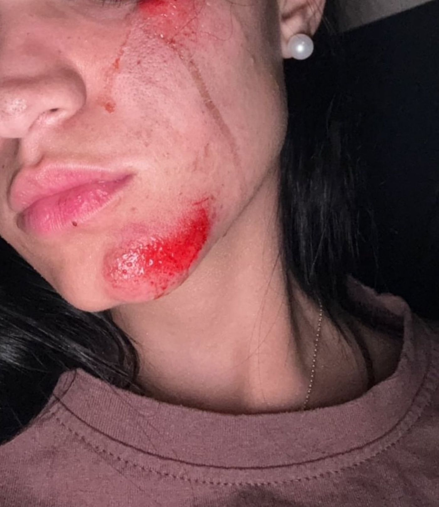 Las mujeres accidentadas en moto terminaron con distintos golpes y heridas, sobre el asfalto