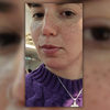 La dura carta de la joven que pidió que le resalten las pecas y terminaron arruinándole la cara