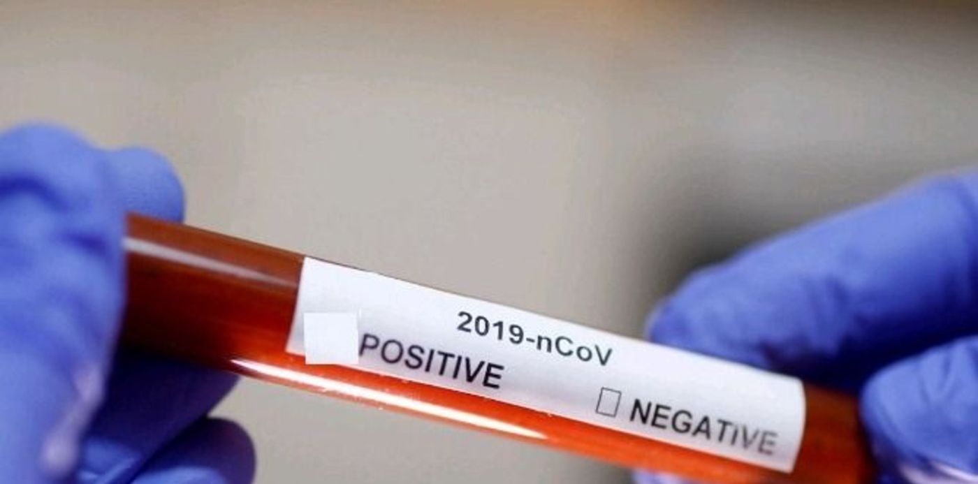 1582918552843.jpg?&cw=1920&ch=950