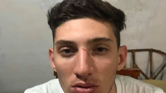 archivaron la causa a un rugbier de la plata acusado de lesionar a basquetbolista