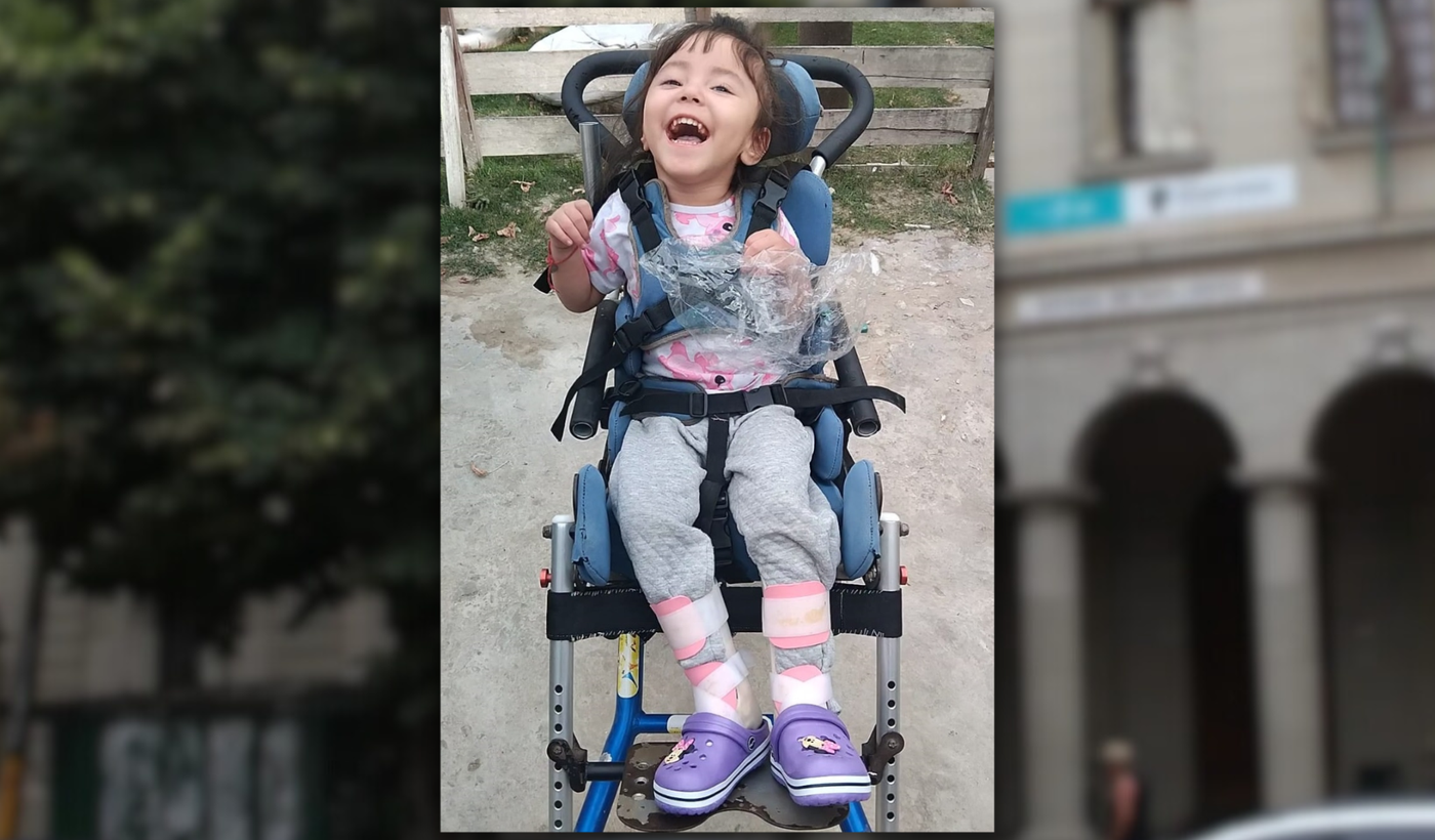 Luna la nena con hidrocefalia (3).png