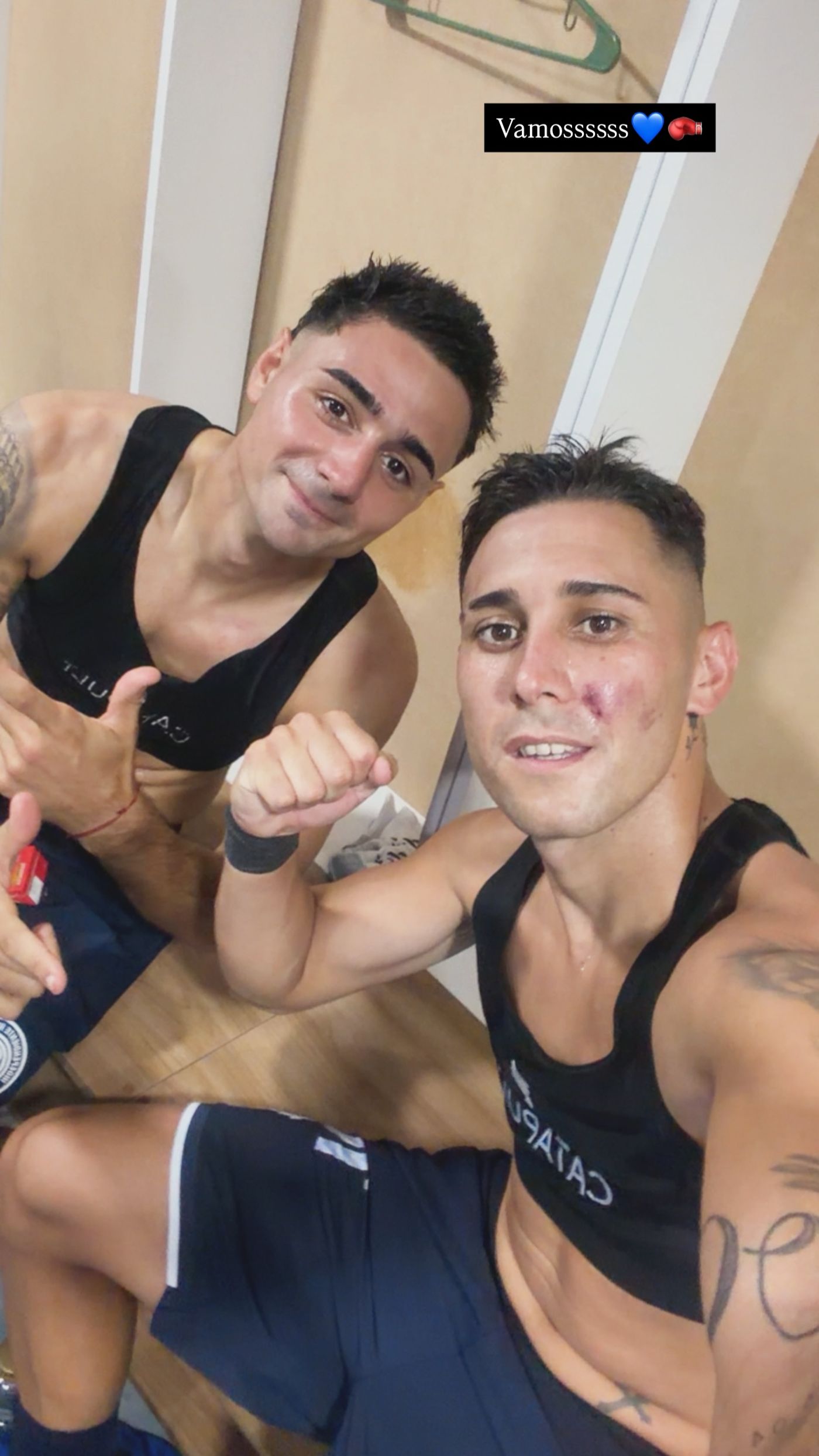 Matías Fernández mostró en sus redes la herida tras el curce con Enzo Martínez