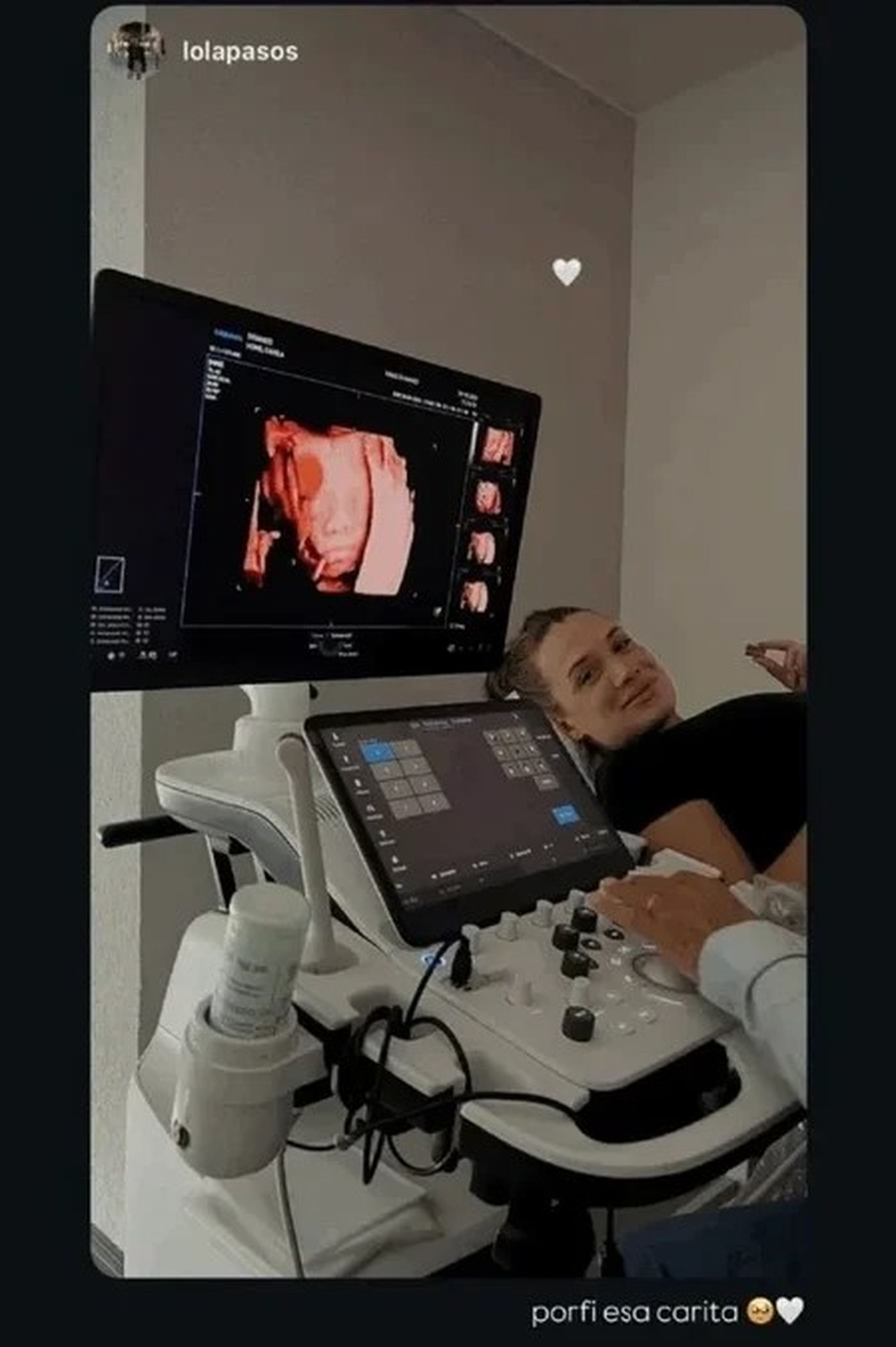 Camila Homs compartió una imagen de su bebe en ecografía 4D