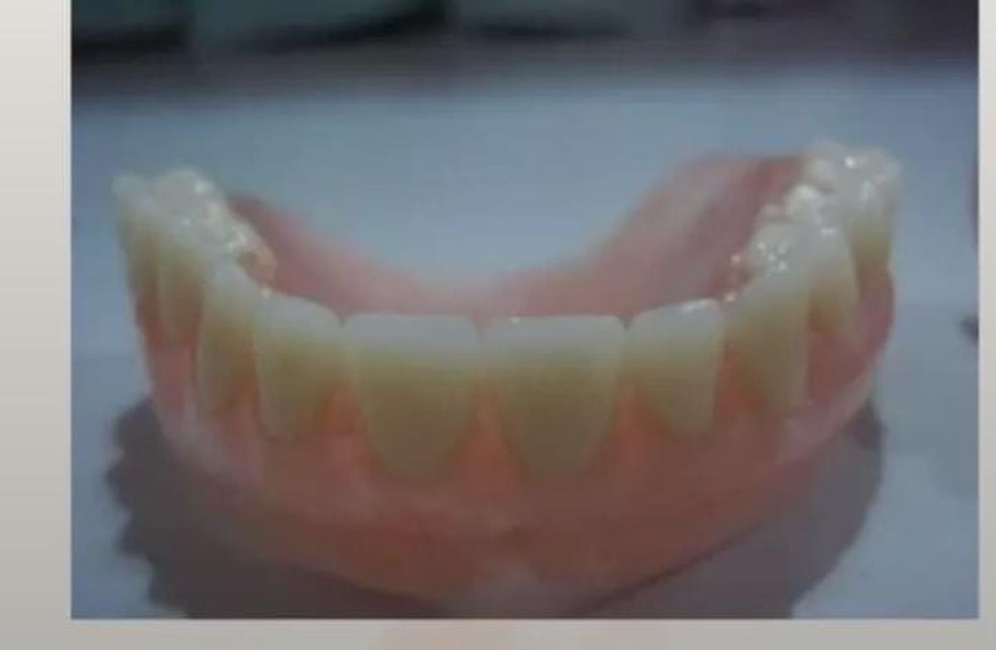 La foto de la dentadura que aportó el hombre que la perdió en la calle