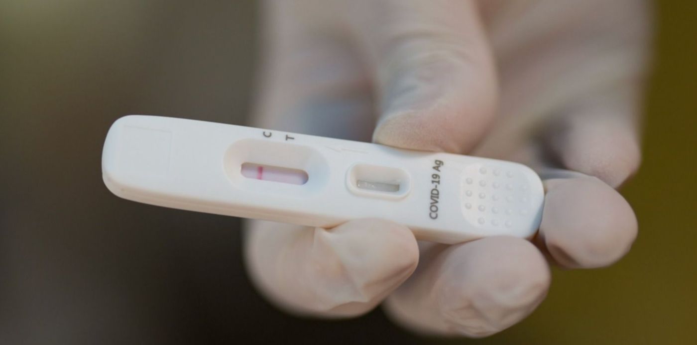 test coronavirus