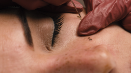 se hizo una micropigmentacion que salio mal y denuncia que le danaron la cara