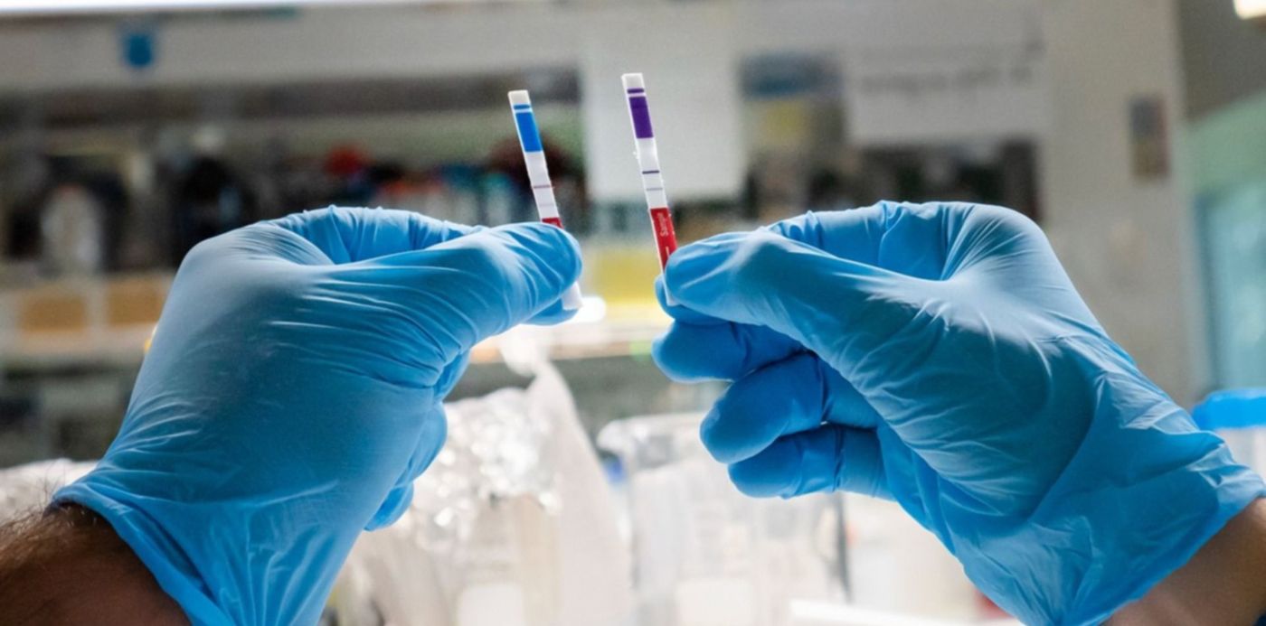 test Chemstrip Covid19