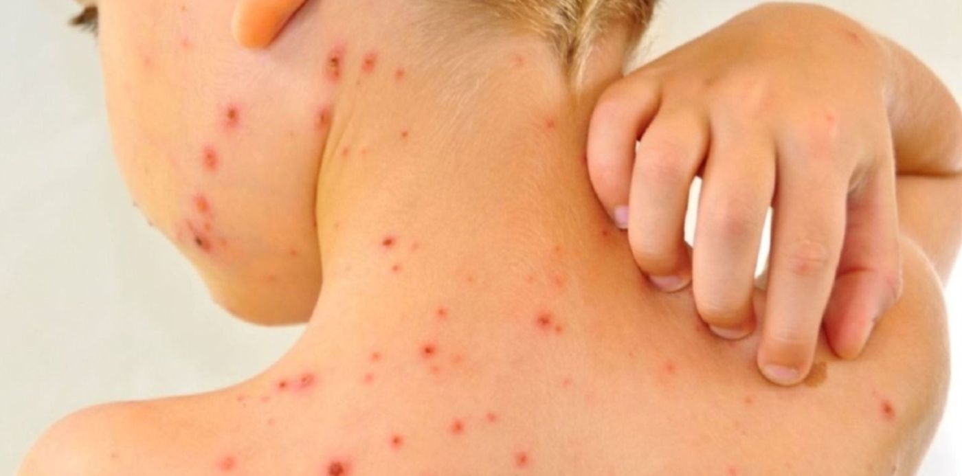 1594388827720.jpg?x= 3&y=103&width=1493&height=747&rotate=0&scaleX=1&scaleY=1&ow=1500&oh=999&&cw=1920&ch=950