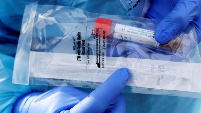 tests de anticuerpos: ¿por que algunas personas generan tantos y otras tan pocos?