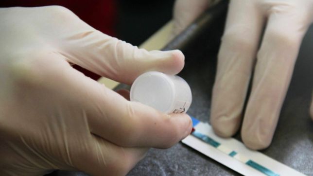 la unlp realizara pruebas gratuitas de hiv, sifilis y hepatitis virales