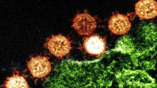 la unlp creo un test que detecta al covid-19 en 5 minutos