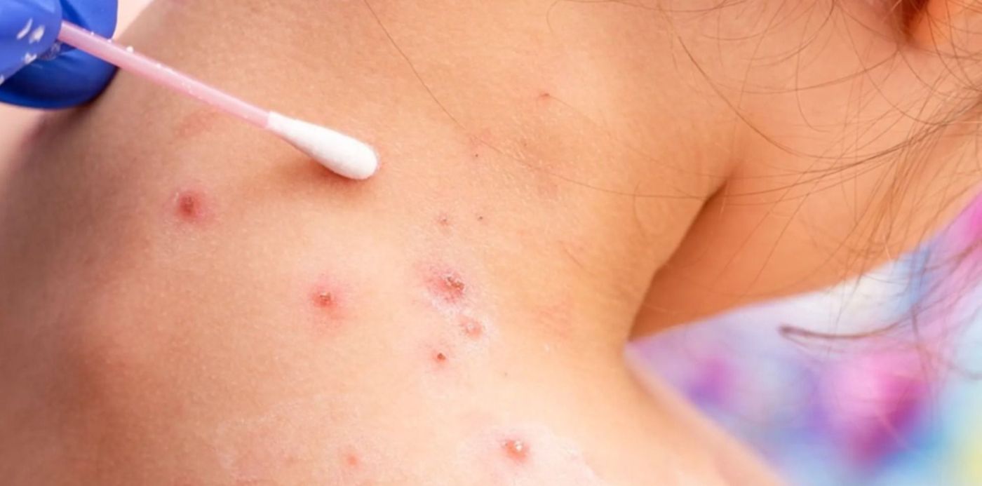 1653314249370.jpg?x= 8&y=91&width=1505&height=752&rotate=0&scaleX=1&scaleY=1&ow=1500&oh=843&&cw=1920&ch=950