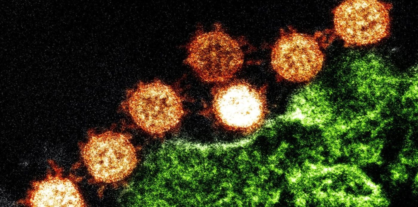 1580068416397.jpg?x=3&y=83&width=1493&height=747&rotate=0&scaleX=1&scaleY=1&ow=1500&oh=999&&cw=1920&ch=950