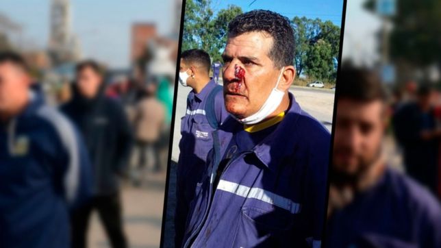 video: asi quedo uno de los heridos en la feroz interna de la uocra y sitraic