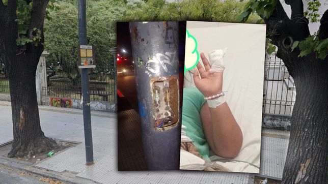 una nena de la plata se apoyo en un poste electrificado y termino internada