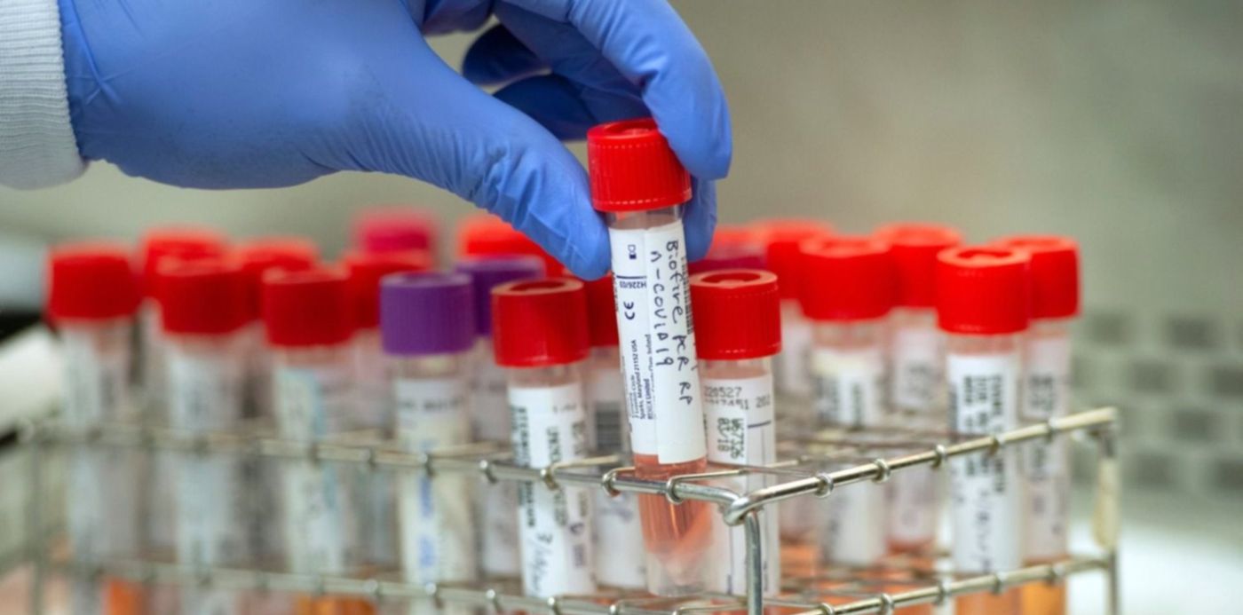 1585424745790.jpeg?&cw=1920&ch=950