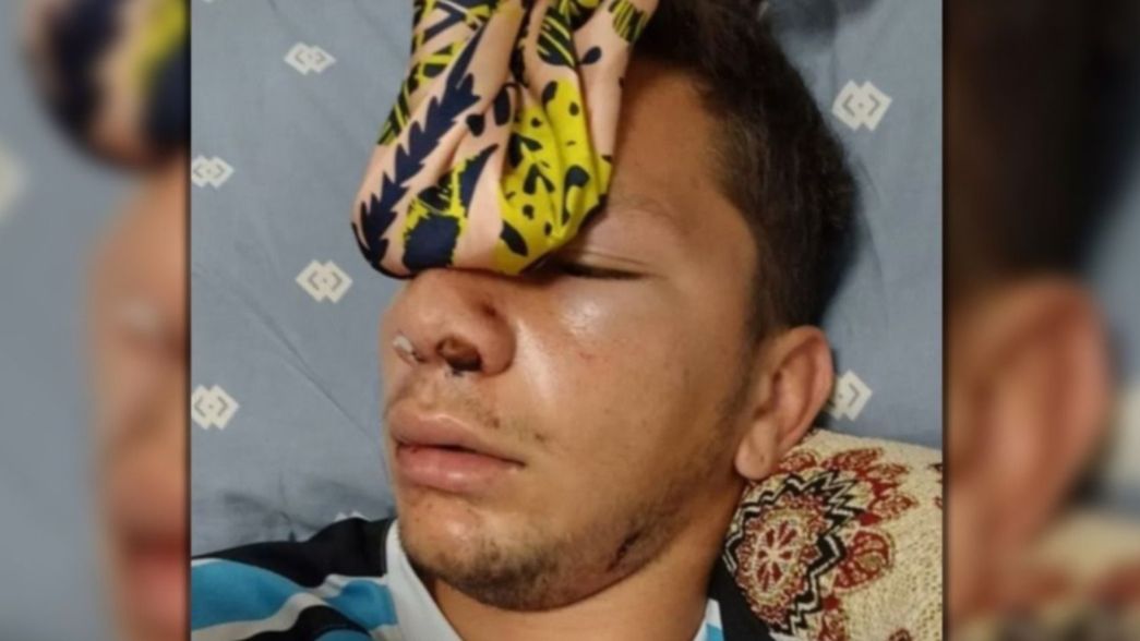 Estuvo muerto por dos minutos: brutal golpiza en la Liga Amateur Platense