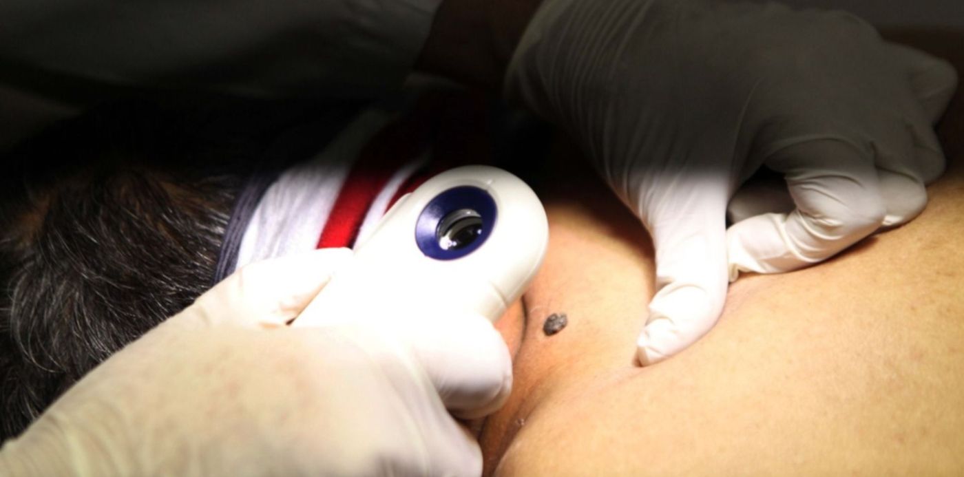 controles - municipio