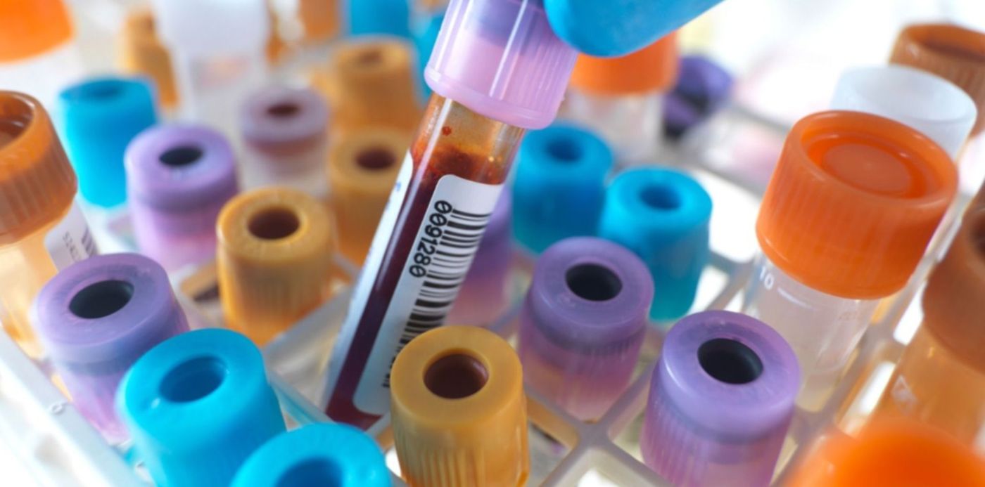 1587522143388.jpg?ow=1500&oh=1124&y=262&height=742&rotate=0&scaleY=1&x=8&width=1485&scaleX=1&&cw=1920&ch=950