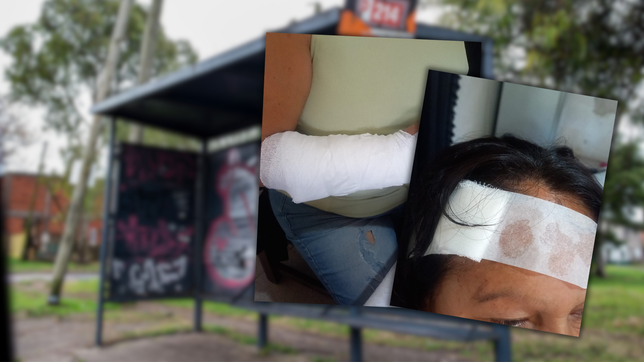 fracturaron a una mujer y le abrieron la cabeza mientras esperaba el micro