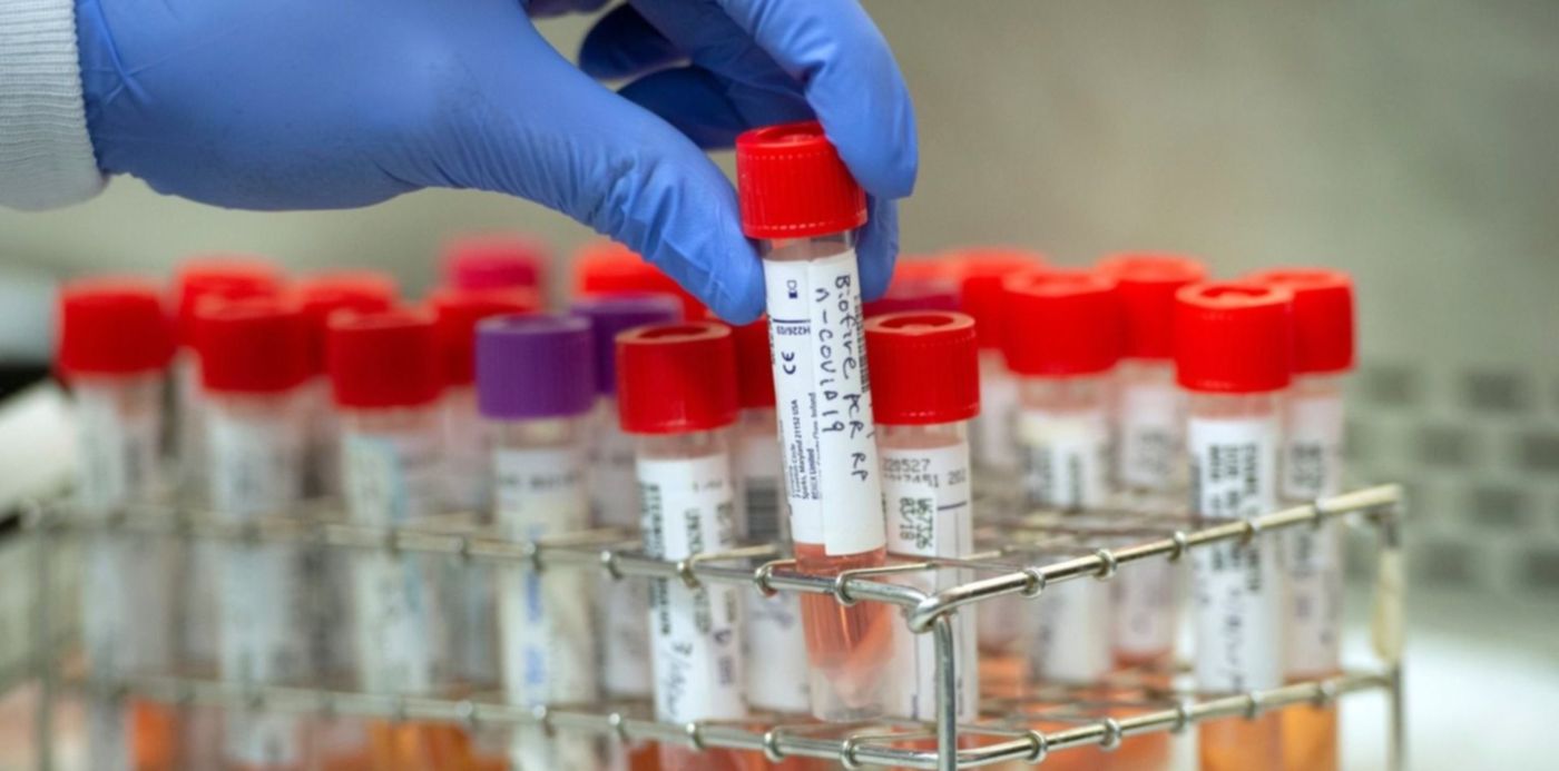 1585424745790.jpeg?height=748&scaleX=1&oh=968&y=26&width=1497&rotate=0&scaleY=1&ow=1500&x=2&&cw=1920&ch=950