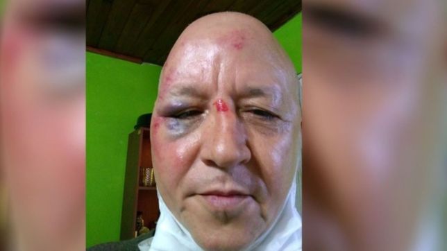 atacaron con una baldosa a un conocido artista de la region: me podria haber matado