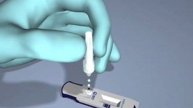 como es el test aprobado por la anmat que permite diagnosticar covid-19 en solo 15 minutos