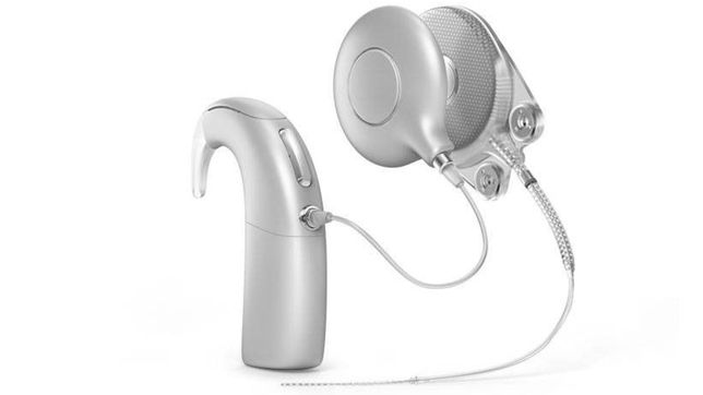 una joven pide ayuda para encontrar el implante que le permite oir y perdio en la calle