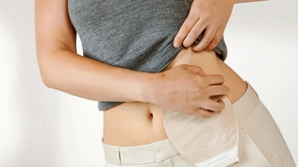 Con un operativo de emergencia, PAMI entrega elementos de ostomía a sus afiliados