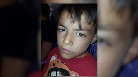 Lanzan una colecta en La Plata para ayudar a Lauchi a conseguir una prótesis ocular y volver a la escuela Lanzan una colecta en La Plata para ayudar a Lauchi a conseguir una prótesis ocular y volver a la escuela