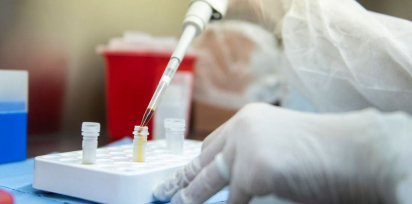 1585839940529.jpg?ow=1280&rotate=0&scaleX=1&width=1253&height=627&scaleY=1&oh=799&x=11&y=143&&cw=1920&ch=950