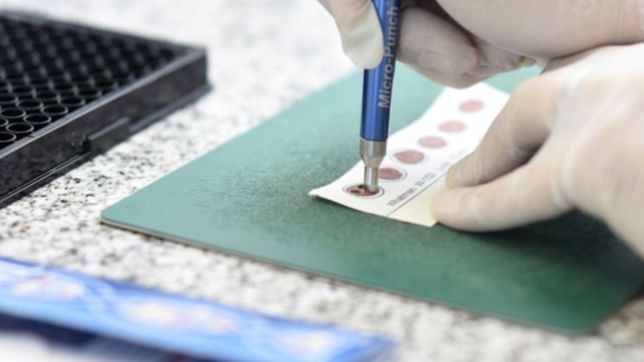 un centro de la unlp es el unico en argentina en diagnosticar una patologia poco frecuente