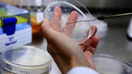 Científicos de La Plata desarrollan un dispositivo con inteligencia artificial para detectar hepatitis E Científicos de La Plata desarrollan un dispositivo con inteligencia artificial para detectar hepatitis E