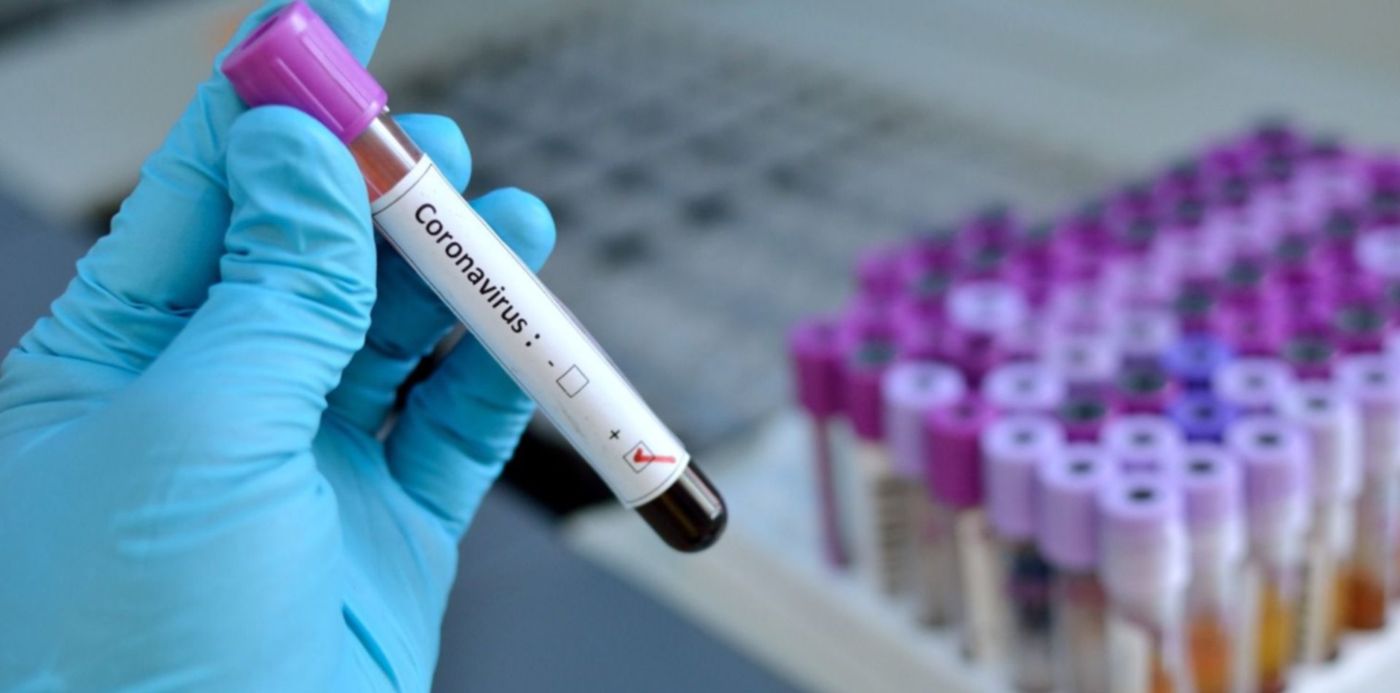 1584104954298.jpg?scaleX=1&oh=849&y=59&height=747&rotate=0&ow=1500&x=3&width=1494&scaleY=1&&cw=1920&ch=950