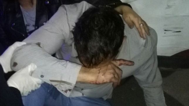 fue atacado por patovicas de mute, lo desfiguraron y podria perder la vision de un ojo