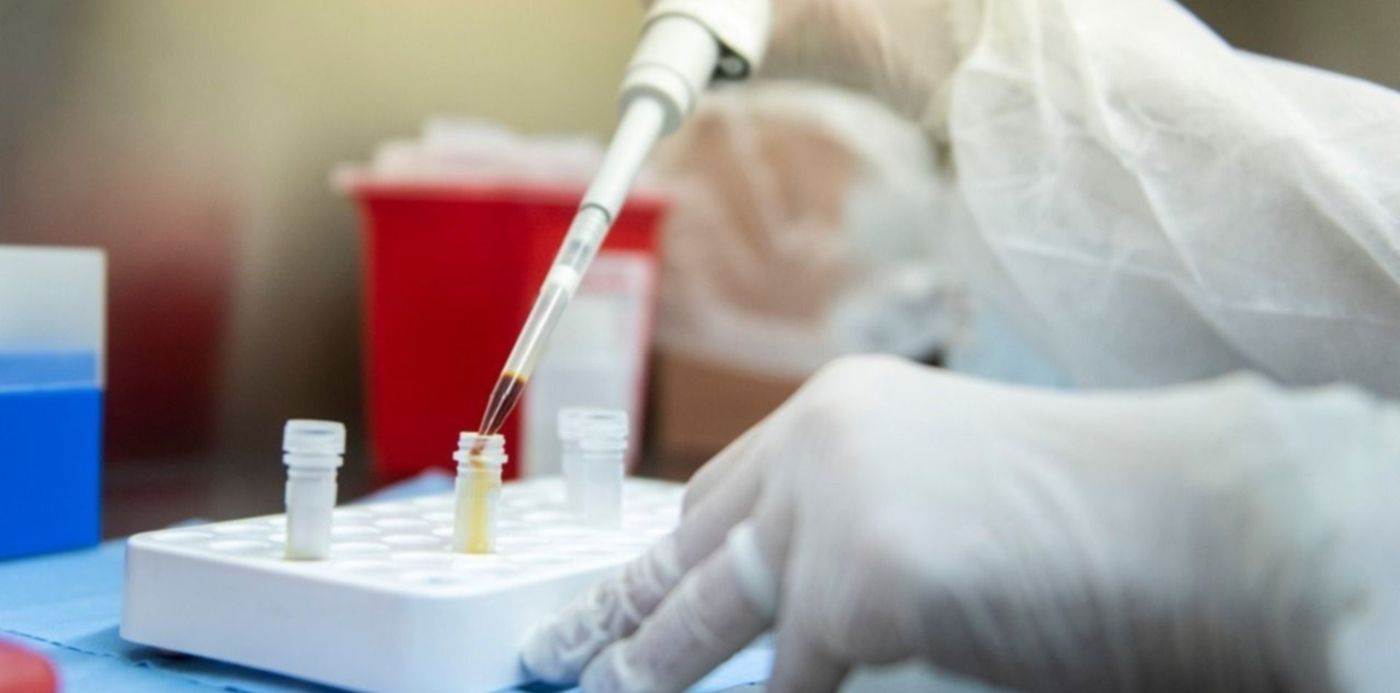 1585839940529.jpg?x=0&y=130&width=1280&height=640&rotate=0&scaleX=1&scaleY=1&ow=1280&oh=799&&cw=1920&ch=950