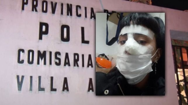apresaron al hombre que desfiguro a golpes a su expareja en berisso