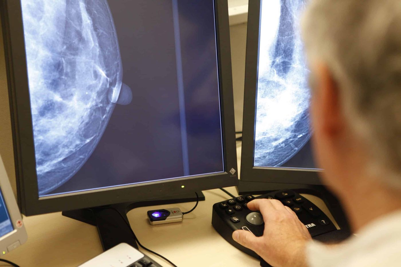 Mamografías (2).jpg