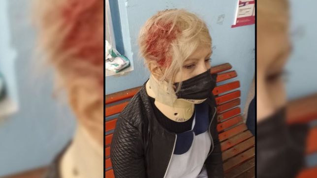 se desprendio la ventana de una escuela y una docente resulto herida en la plata