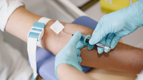 Prueba-hepatitis-A-optimized.jpg
