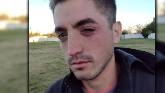 un equipo de futbol platense fue protagonista de una batalla campal con heridos